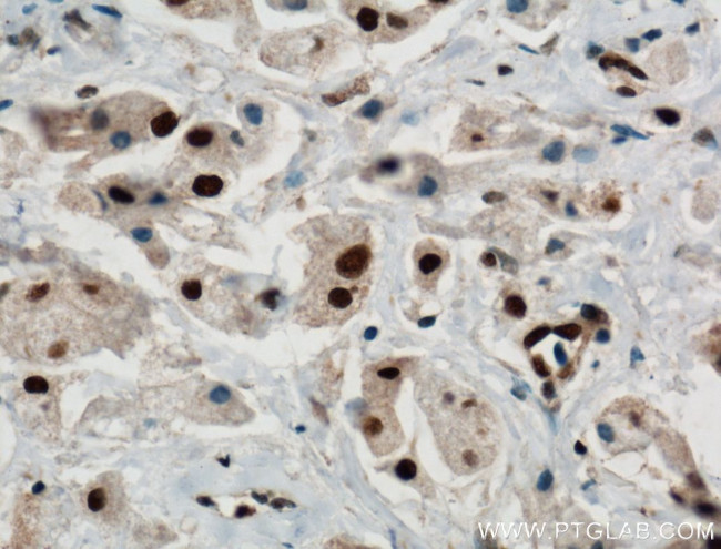 PARP1 Antibody in Immunohistochemistry (Paraffin) (IHC (P))