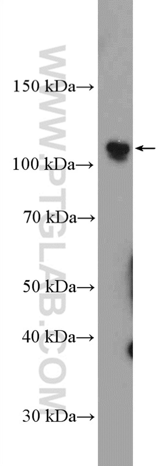 PARP1 Antibody in Western Blot (WB)