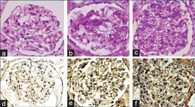 PCNA Antibody in Immunohistochemistry (IHC)