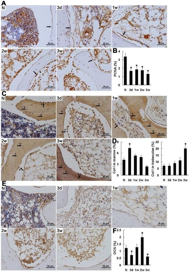 PCNA Antibody in Immunohistochemistry (IHC)