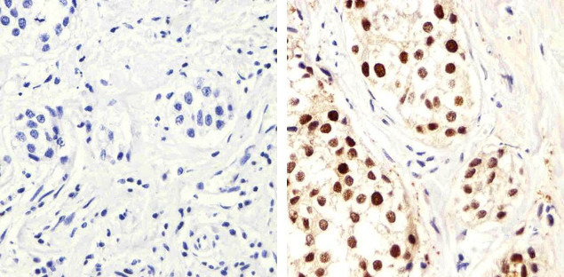 PCNA Antibody in Immunohistochemistry (Paraffin) (IHC (P))