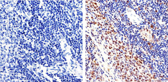 PCNA Antibody in Immunohistochemistry (Paraffin) (IHC (P))