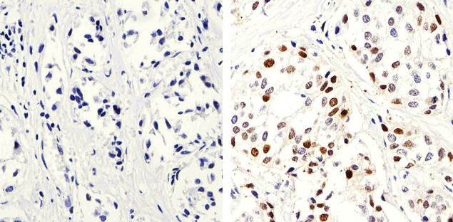 PCNA Antibody in Immunohistochemistry (Paraffin) (IHC (P))