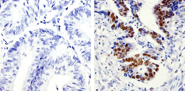 PCNA Antibody in Immunohistochemistry (Paraffin) (IHC (P))