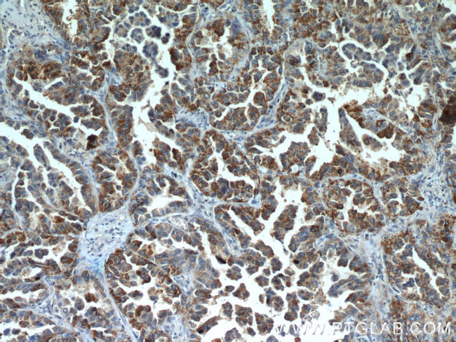 MX1 Antibody in Immunohistochemistry (Paraffin) (IHC (P))