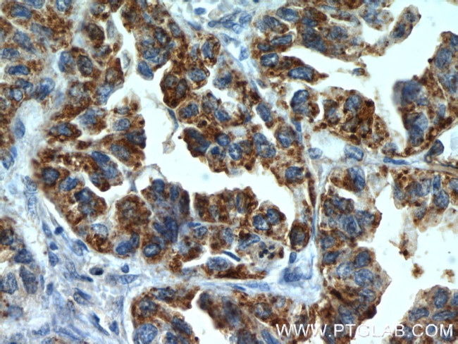 MX1 Antibody in Immunohistochemistry (Paraffin) (IHC (P))