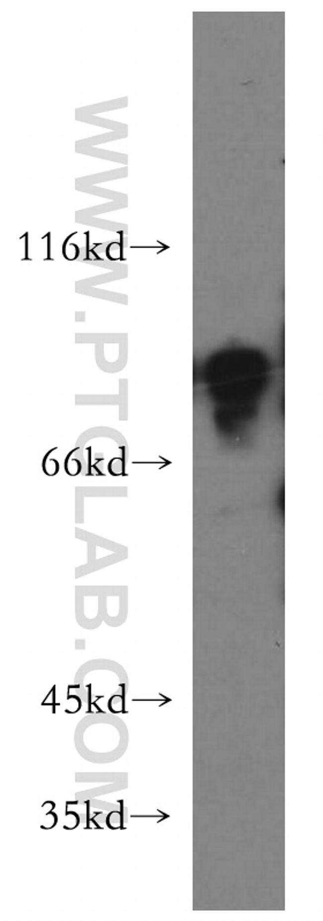 MX1 Antibody in Western Blot (WB)