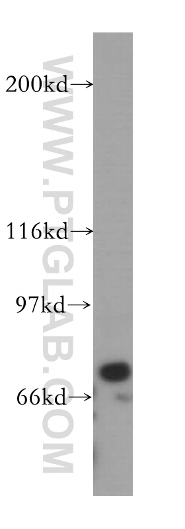 MX1 Antibody in Western Blot (WB)