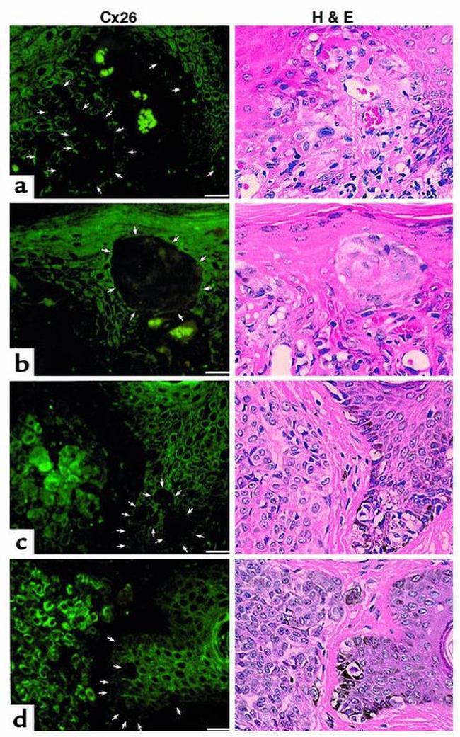 Connexin 26 Antibody in Immunohistochemistry (IHC)