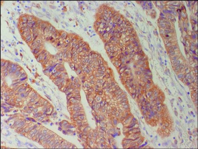 Connexin 26 Antibody in Immunohistochemistry (IHC)