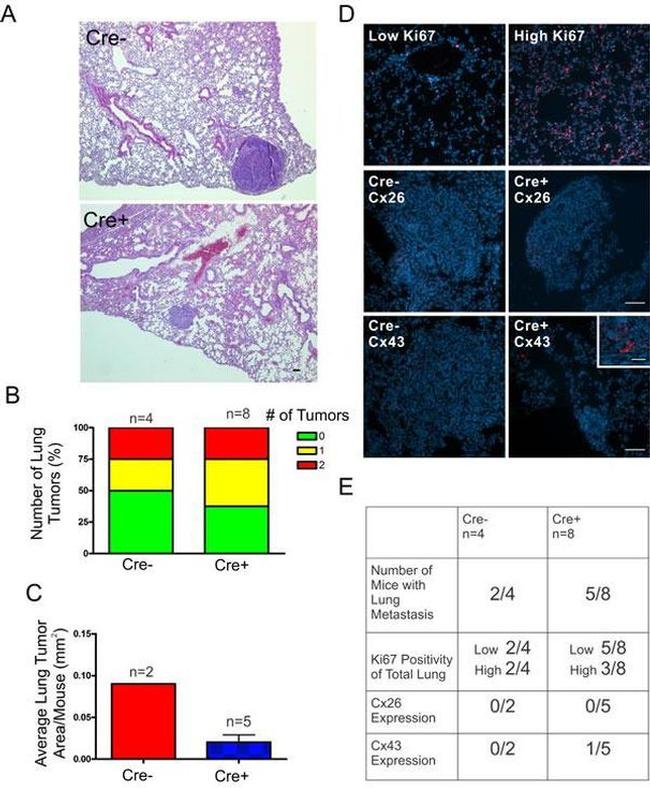 Connexin 26 Antibody in Immunohistochemistry (IHC)