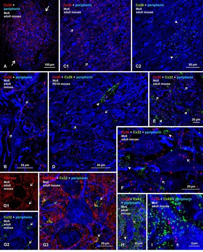 Connexin 26 Antibody in Immunohistochemistry (IHC)