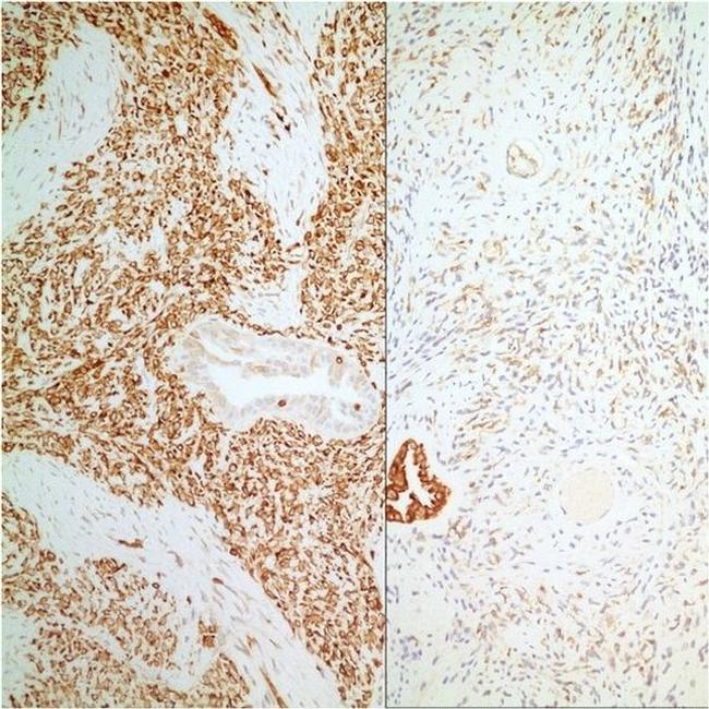 Bcl-2 Antibody in Immunohistochemistry (IHC)