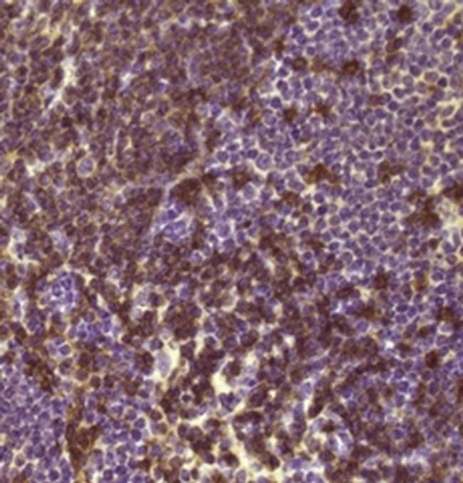 CD45R (B220) Antibody in Immunohistochemistry (Paraffin) (IHC (P))