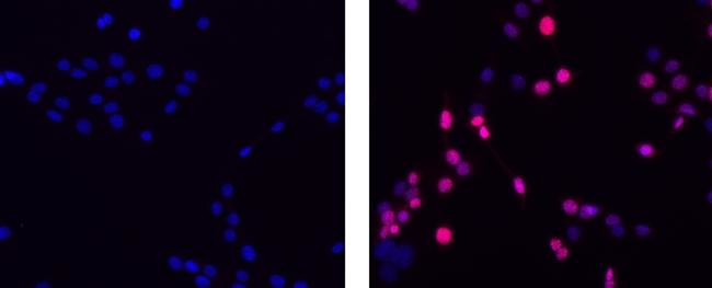 Rat IgG2a kappa Isotype Control in Immunocytochemistry (ICC/IF)