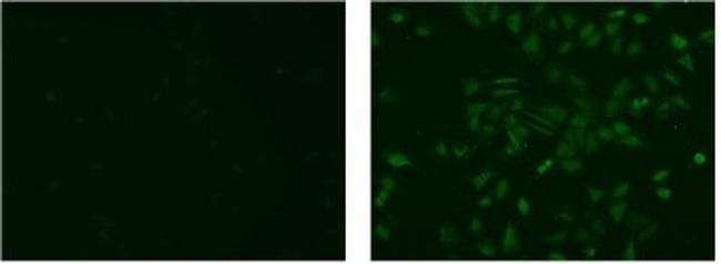 Rat IgG2a kappa Isotype Control in Immunocytochemistry (ICC/IF)