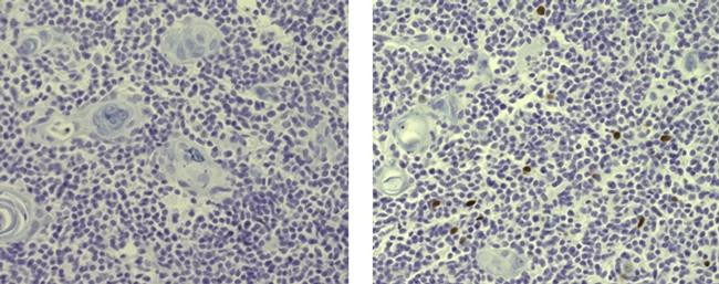 Rat IgG2a kappa Isotype Control in Immunohistochemistry (Paraffin) (IHC (P))