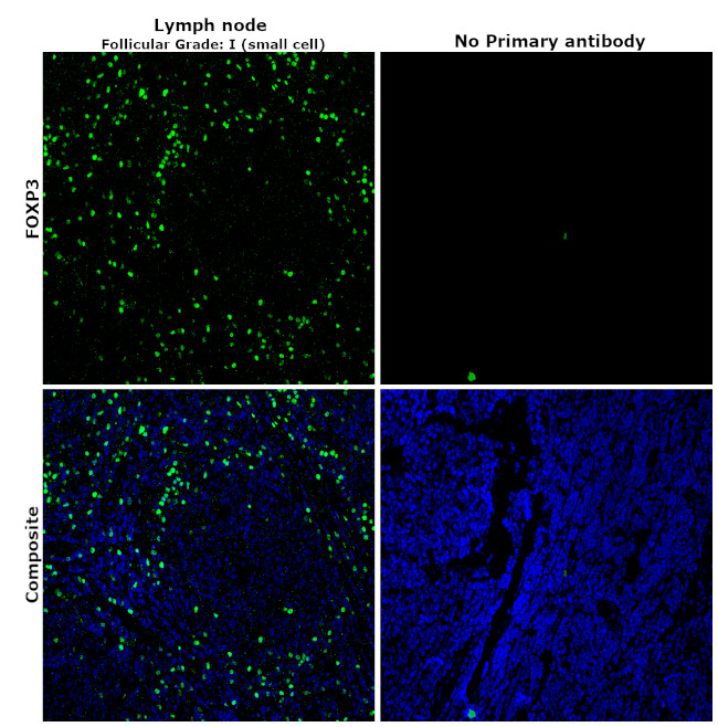 FOXP3 Antibody in Immunohistochemistry (Paraffin) (IHC (P))