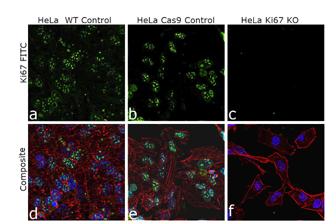 Ki-67 Antibody in Immunocytochemistry (ICC/IF)