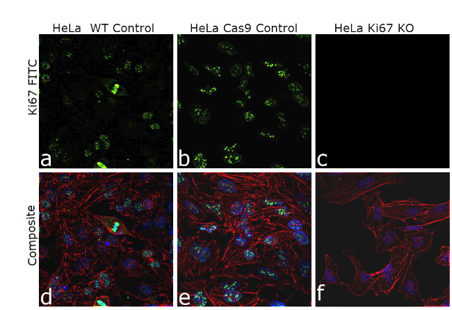 Ki-67 Antibody in Immunocytochemistry (ICC/IF)