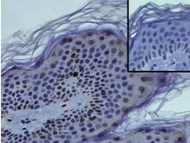 Ki-67 Antibody in Immunohistochemistry (Paraffin) (IHC (P))