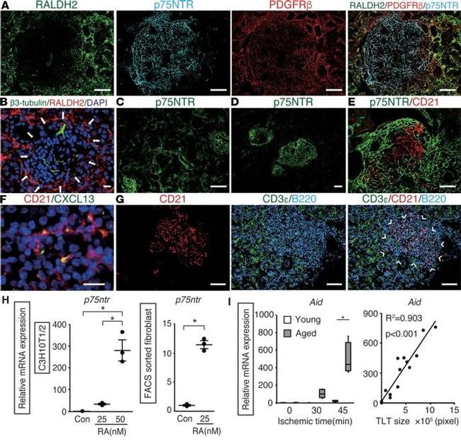 CD45 Antibody in Immunohistochemistry (Paraffin) (IHC (P))