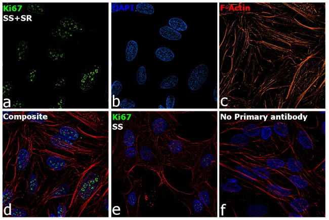 Ki-67 Antibody in Immunocytochemistry (ICC/IF)