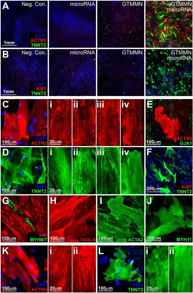 Ki-67 Antibody in Immunohistochemistry (IHC)