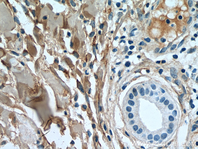 Collagen Type I Antibody in Immunohistochemistry (Paraffin) (IHC (P))