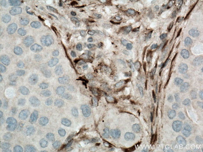 Collagen Type I Antibody in Immunohistochemistry (Paraffin) (IHC (P))