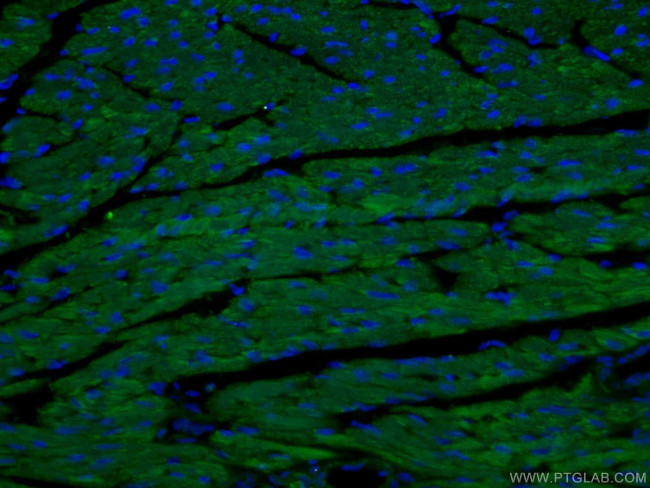 SDHA Antibody in Immunohistochemistry (PFA fixed) (IHC (PFA))