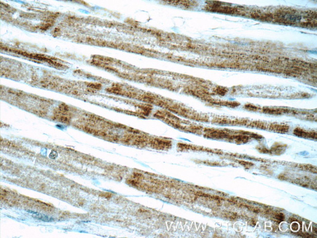 SDHA Antibody in Immunohistochemistry (Paraffin) (IHC (P))