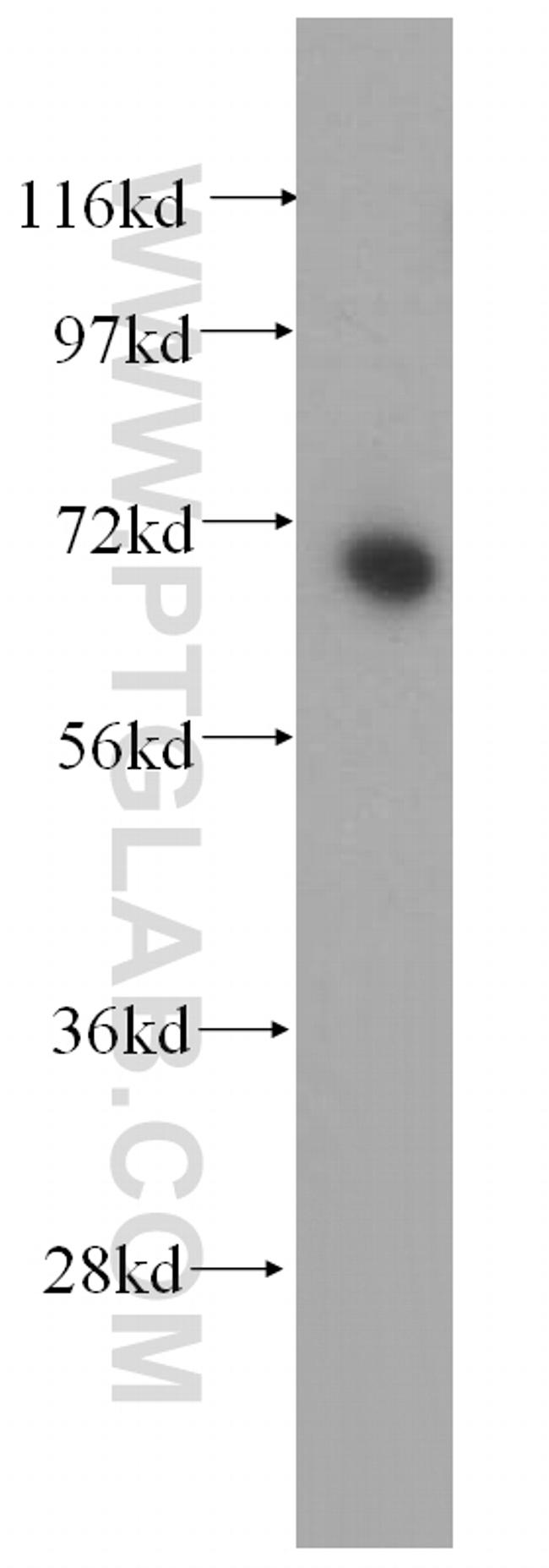 METTL3 Antibody in Western Blot (WB)