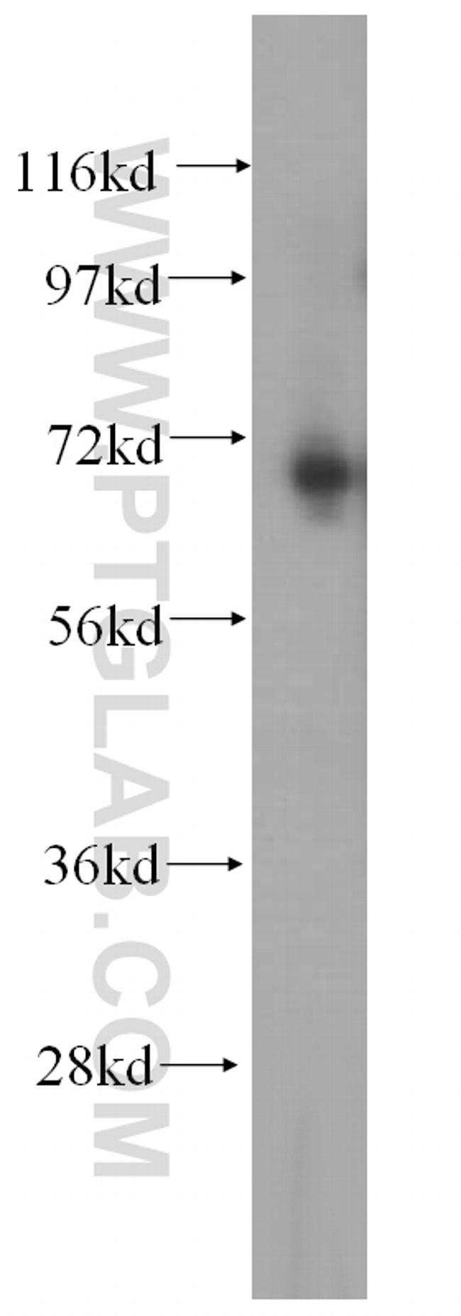 METTL3 Antibody in Western Blot (WB)