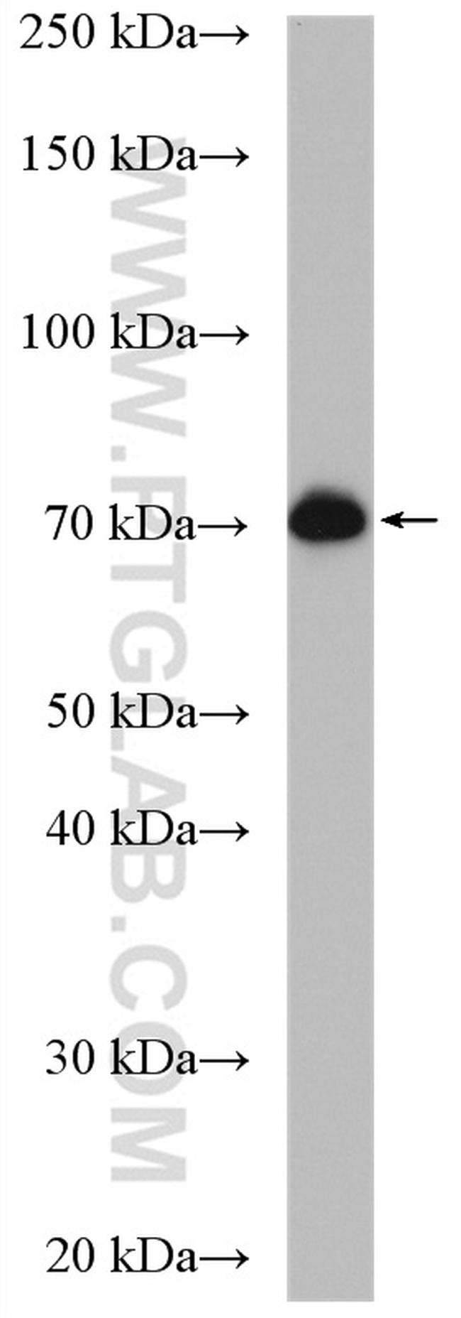 METTL3 Antibody in Western Blot (WB)