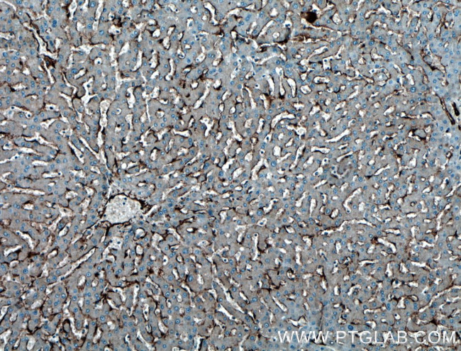 Caveolin-1 Antibody in Immunohistochemistry (Paraffin) (IHC (P))