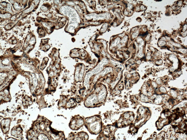 PPAR gamma Antibody in Immunohistochemistry (Paraffin) (IHC (P))