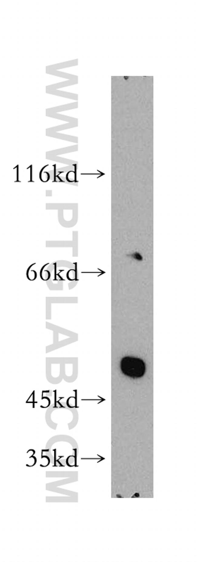 PPAR gamma Antibody in Western Blot (WB)