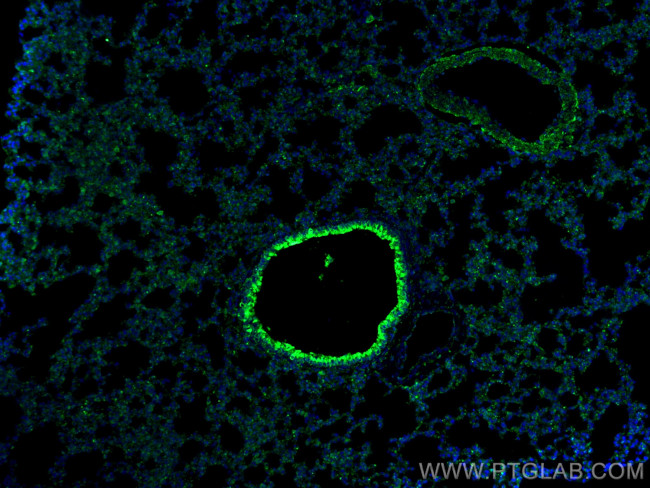 PPAR gamma Antibody in Immunohistochemistry (PFA fixed) (IHC (PFA))