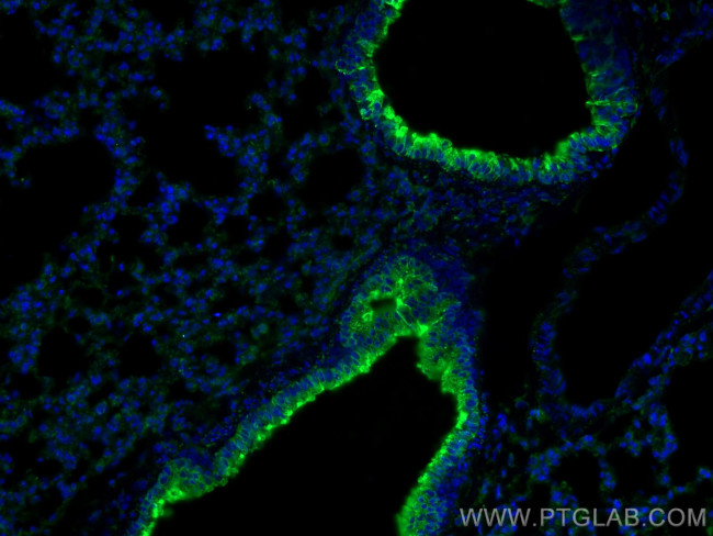 PPAR gamma Antibody in Immunohistochemistry (PFA fixed) (IHC (PFA))