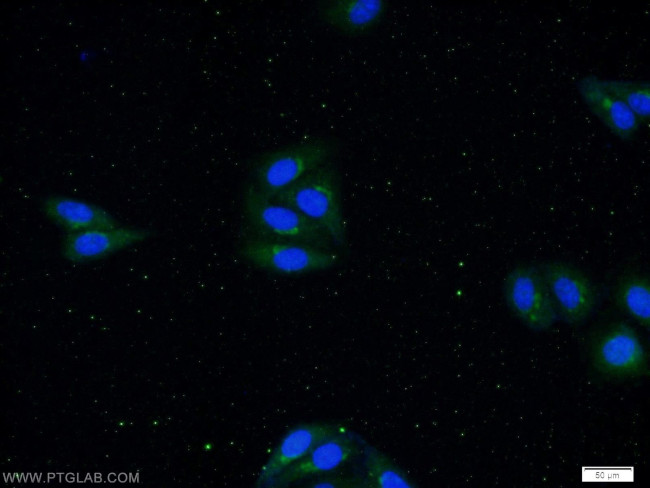 IL1 beta Antibody in Immunocytochemistry (ICC/IF)