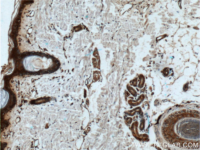 IL1 beta Antibody in Immunohistochemistry (Paraffin) (IHC (P))