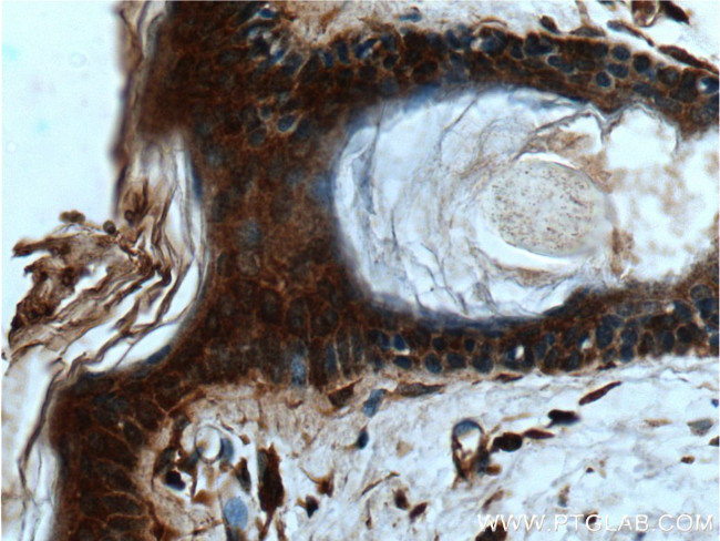 IL1 beta Antibody in Immunohistochemistry (Paraffin) (IHC (P))