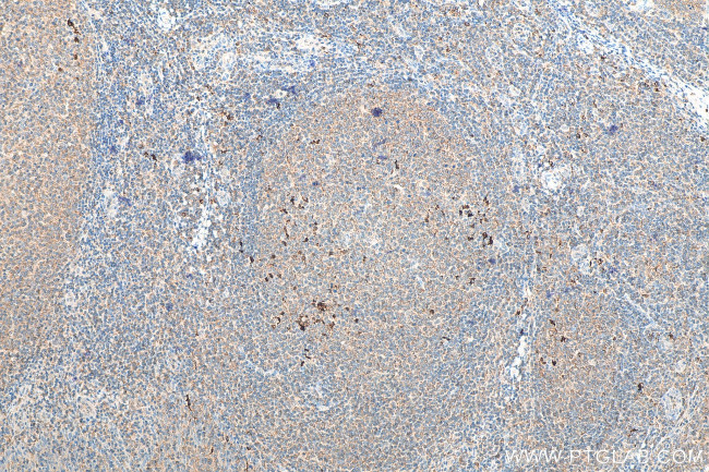 IL1 beta Antibody in Immunohistochemistry (Paraffin) (IHC (P))