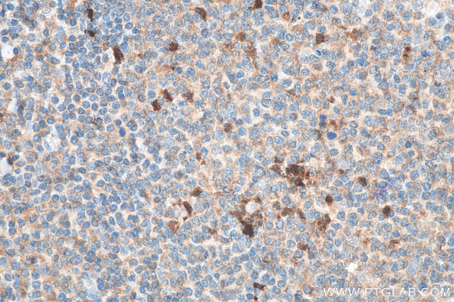 IL1 beta Antibody in Immunohistochemistry (Paraffin) (IHC (P))