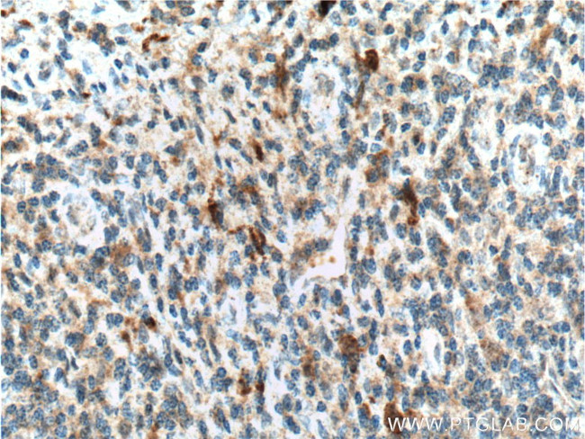 IL1 beta Antibody in Immunohistochemistry (Paraffin) (IHC (P))