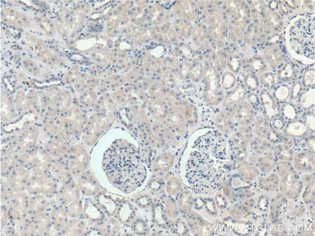 IL1 beta Antibody in Immunohistochemistry (Paraffin) (IHC (P))