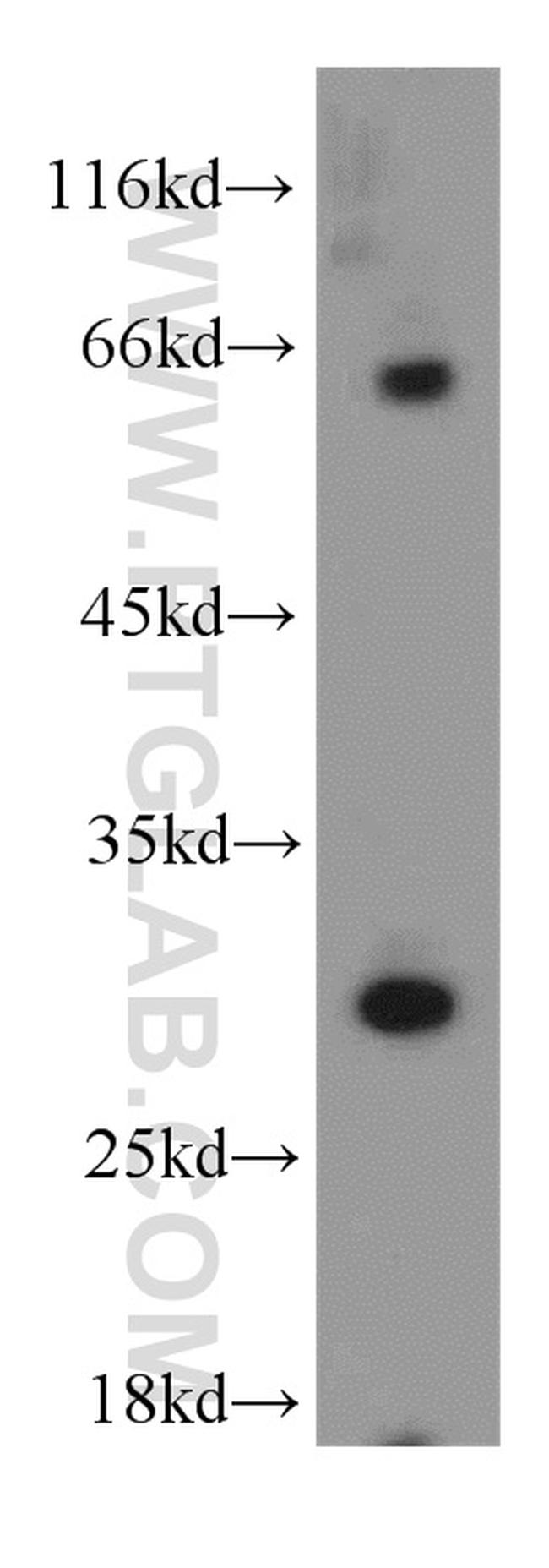 IL1 beta Antibody in Western Blot (WB)