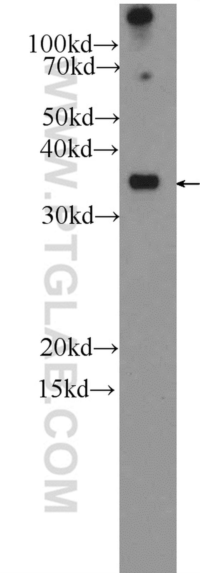 IL1 beta Antibody in Western Blot (WB)