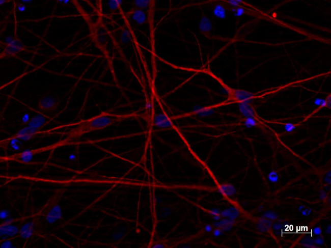 MAP2 Antibody in Immunocytochemistry (ICC/IF)